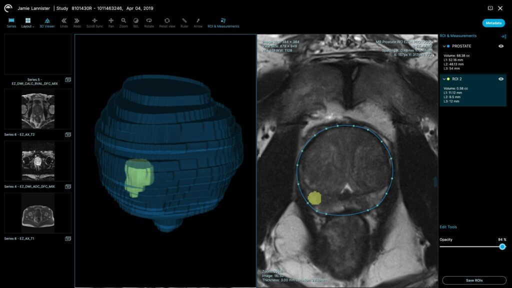 a screenshot of ezra's software showing a highlighted region of an abdominal CT scan